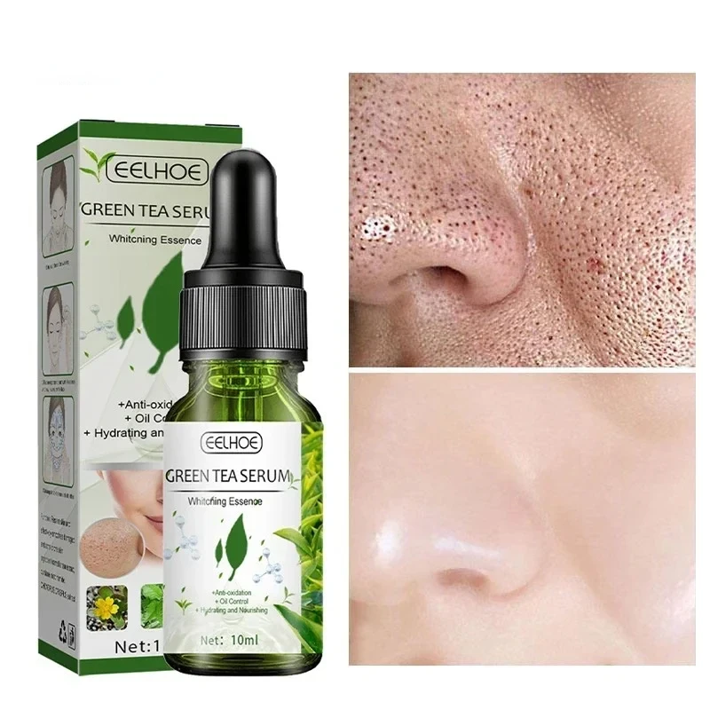 Face Serum Remove Dark Spots